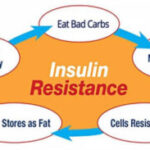 Insulin Resistance